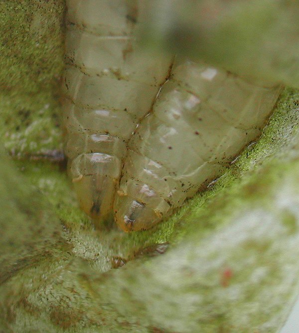 anterior view