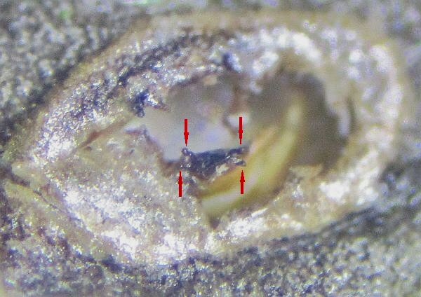 bifid anterior spiracula