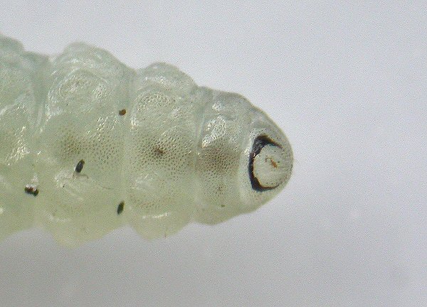 anal ring