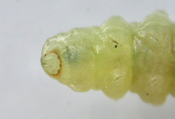 anal ring