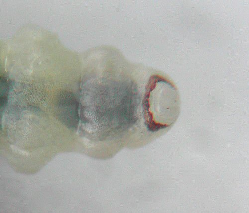 a close up of the anal ring