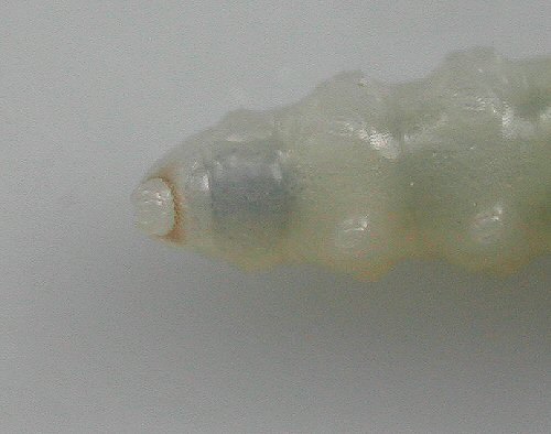 anal ring