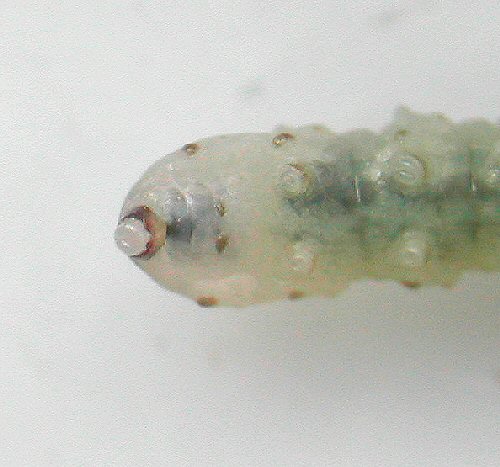 anal ring