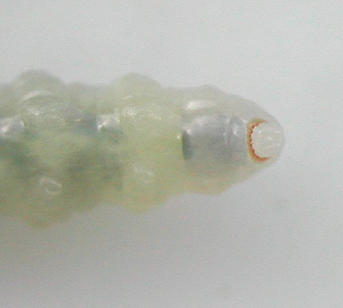 the anal ring is pale in colour and has tiny denticulations