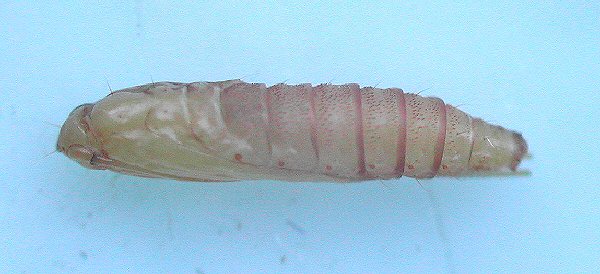 lateral view