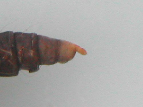lateral view of cremaster