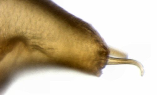 lateral view of cremaster
