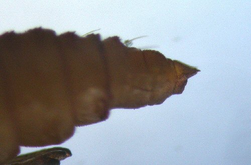 lateral view of cremaster