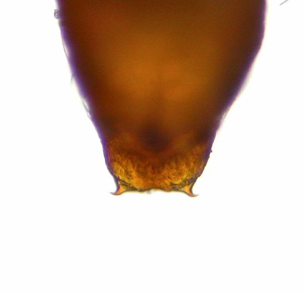 cremaster - dorsal view