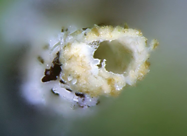 anal opening